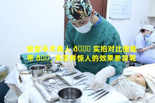 脸型手术真人 🐘 实拍对比图能带 🌸 来怎样惊人的效果差异呢